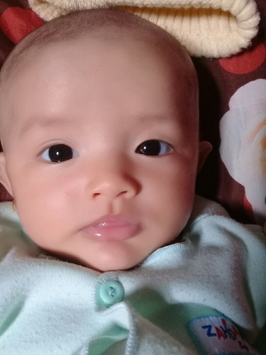 mata sipit sebelah