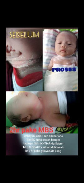 Sabun Kesehatan & Kecantikan