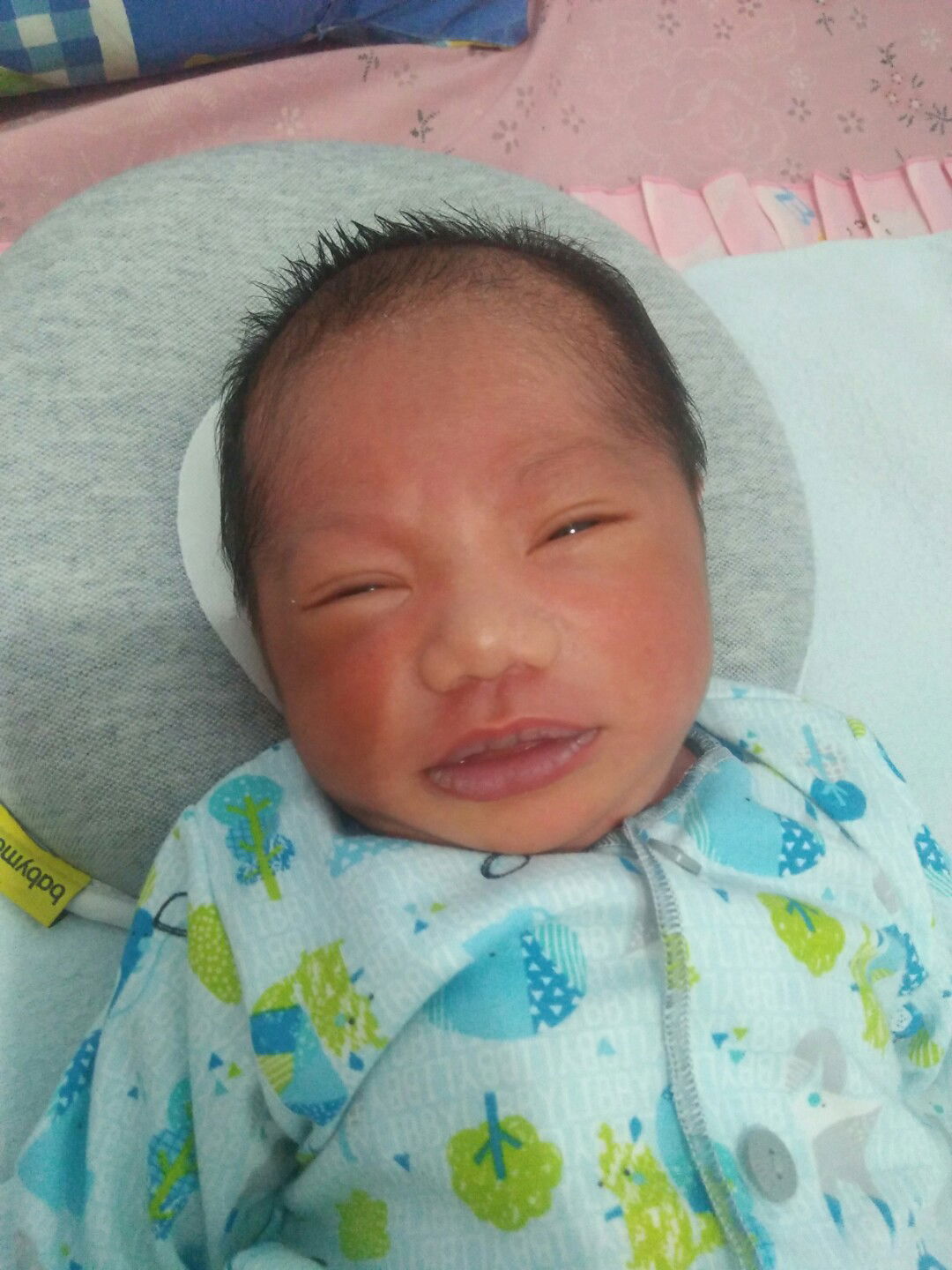 bibir bayi kering