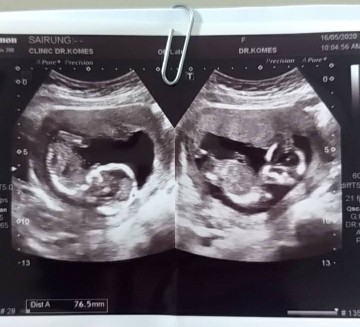 14 week 4 day