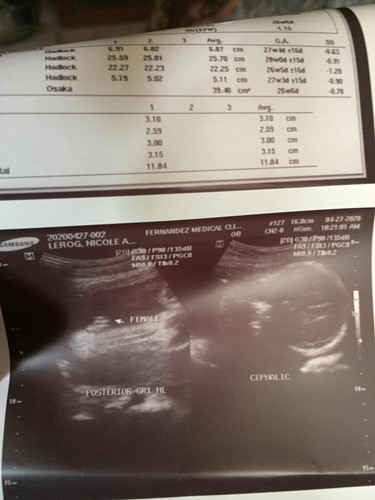 ultrasound