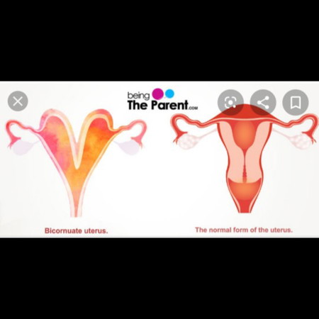 Pengalamanku Anak 1.. di save aja jadi kenangan dan pembelajaran ?