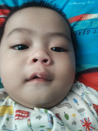 bayi 7 bulan jatuh dr tmpat tdur