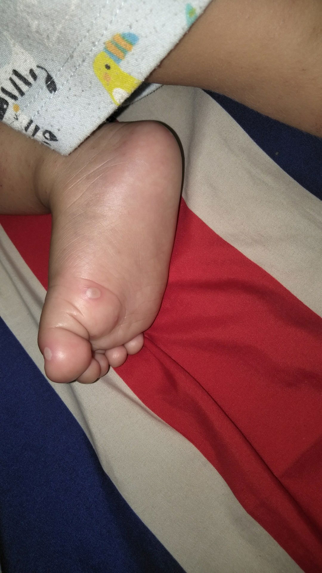 Berawal dari panas tinggi