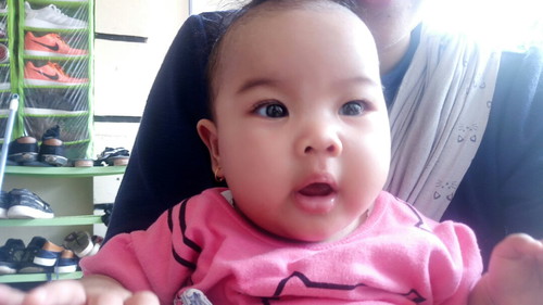 bercak putih diwajah baby