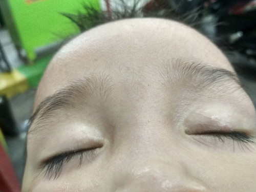Moms Mau Tanya.. Ini Kenapa Ya??