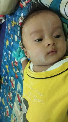 anak belum bisa tegak lehernya