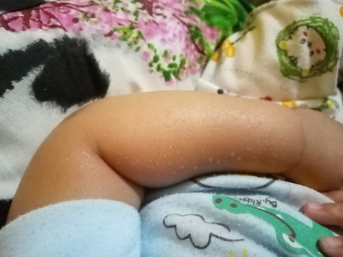 keringat dingin