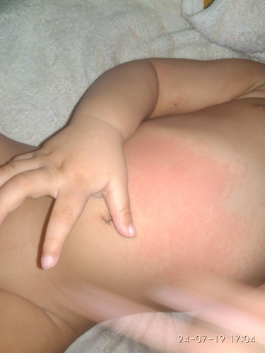 Kulit bayi