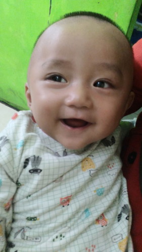 tengkureb