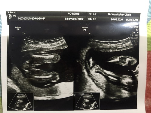 ญ หรือ ช