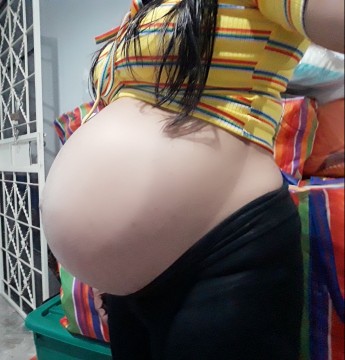 กำหนดคลอด
