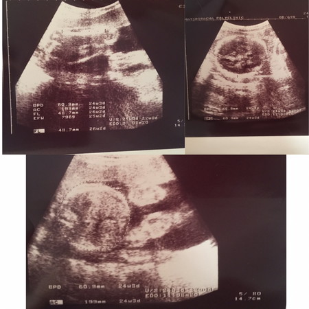 เบบี๋อยู่ตรงไหนคะ