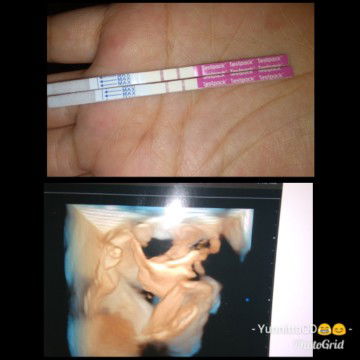 Merasa takut saat hamil pertama