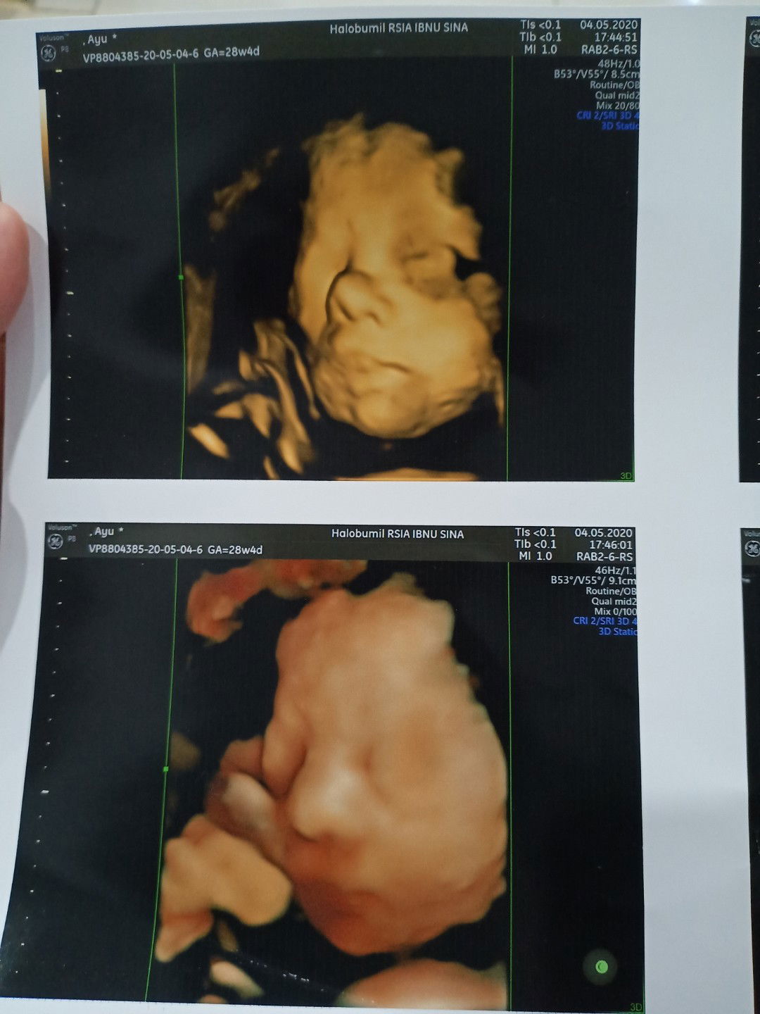 menaikan berat badan bayi dalam kandungan