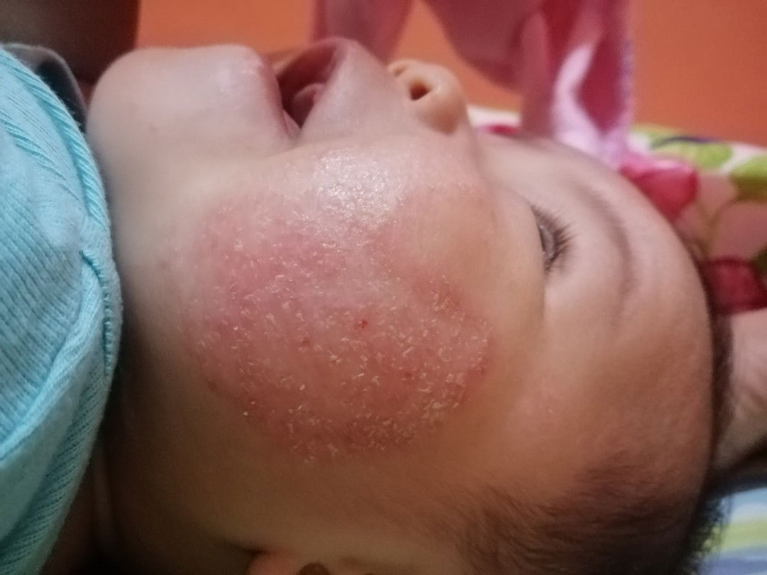 Sinong Baby Nila Na Naka Ranas Ng Ganito ?