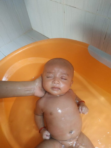 Ngantuk berat