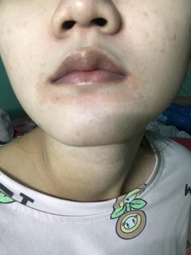 ช่วยด้วยยย