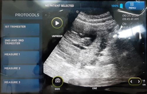 หมอนัดซาว 12w3d