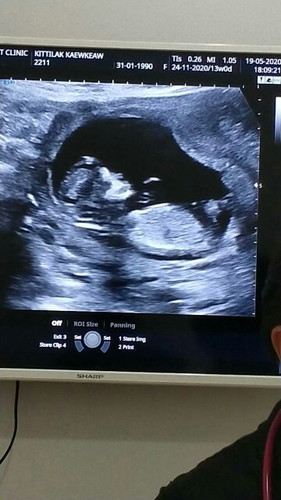13w3d