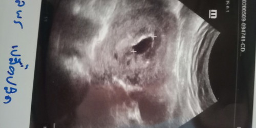 ดูไม่เปน