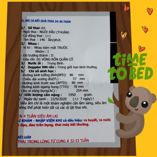 1 vòng dây quấn cổ thai nhi 33 tuần??
