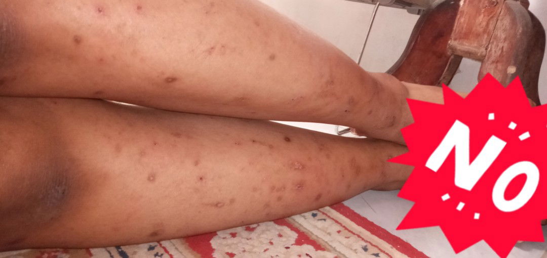 gmna si cara mengatasi nya