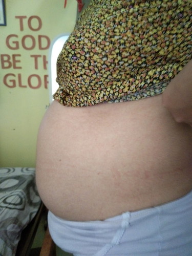 Pregnancy