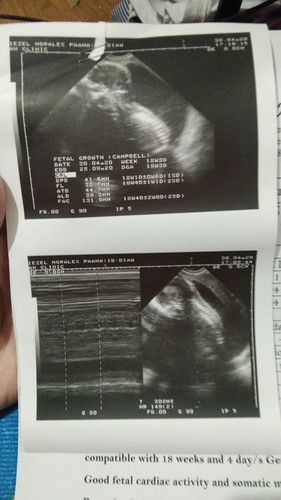 First Ultrasound