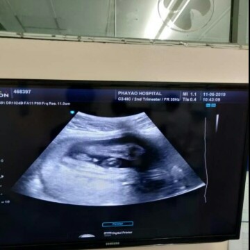 ครึงทางละนะล6เดือนแล้วอีกไม่กี่เดือนเราจะเจอกันละนะ