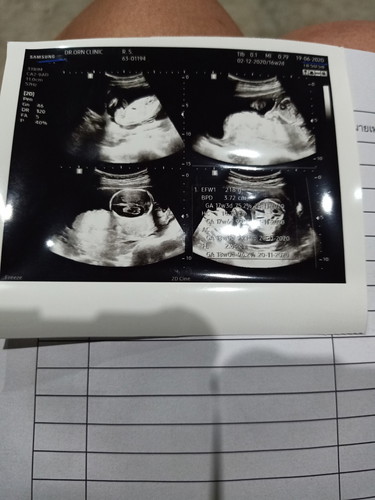ลูกคนแรก
