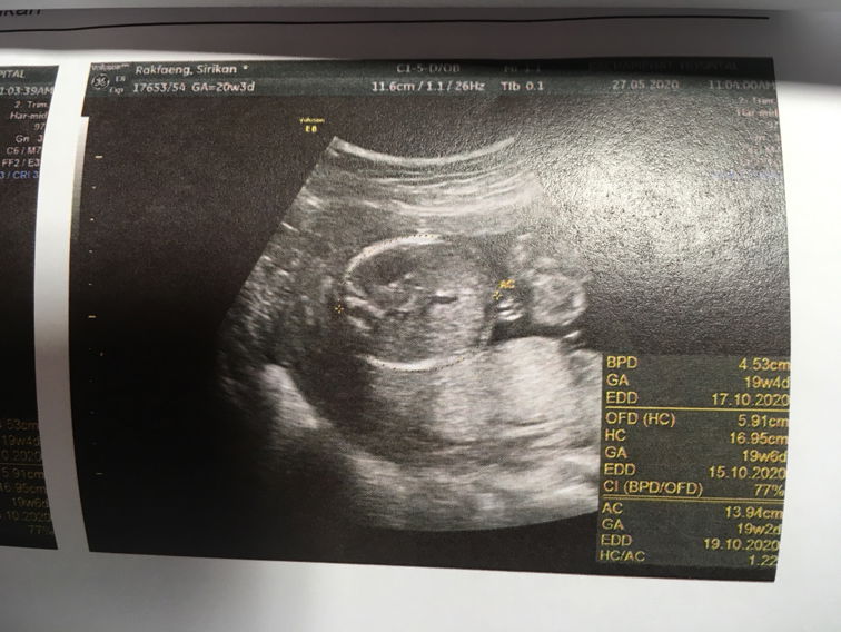 ซาวด์ครั้งแรก รพ.รัฐ ?