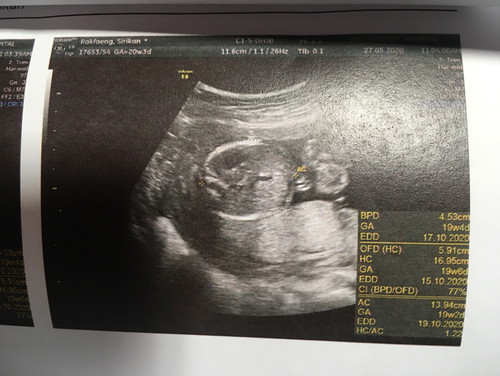 ซาวด์ครั้งแรก รพ.รัฐ ?