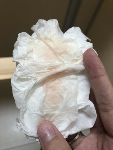 เลือดออก