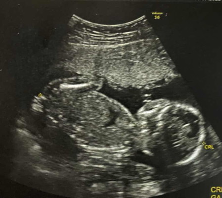 สอบถามแม่ๆบ้านอื่นค่ะ