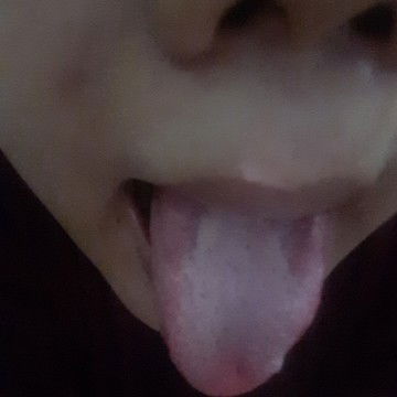 Lidah berwarna putih hamil 7 minggu