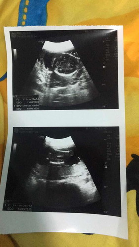 ใบอัตราซาวด์