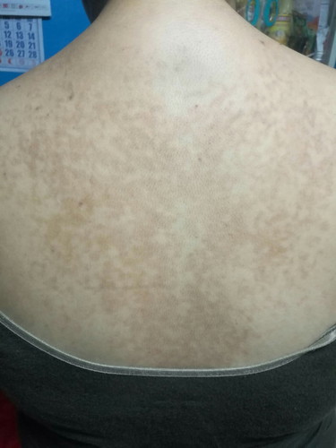 Natural ba 'to? Please pansinin niyo po ako!