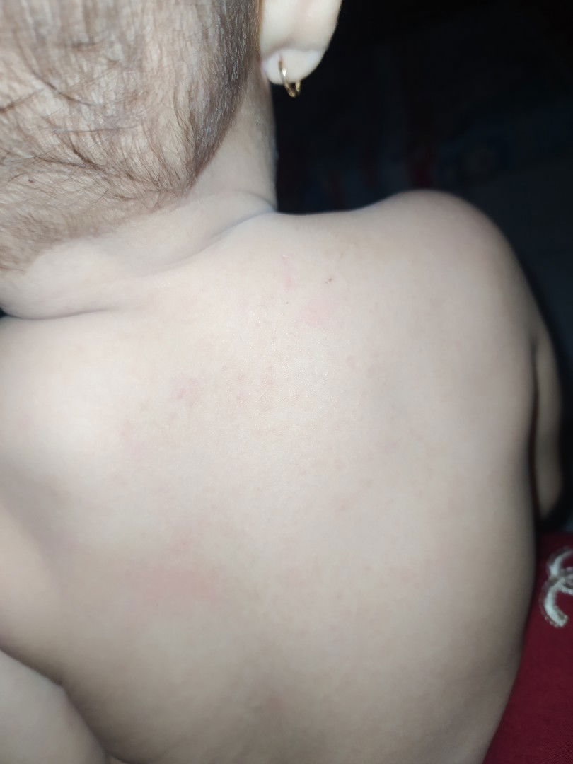 bun kira kira ini kenapa ya ?