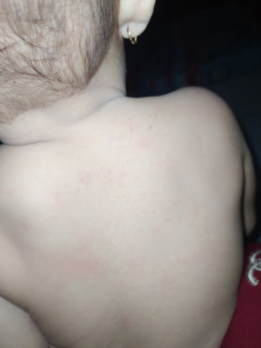 bun kira kira ini kenapa ya ?