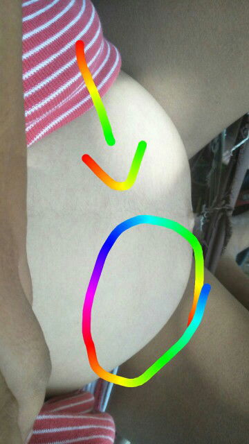 ท้องแข้ง