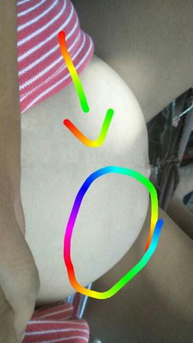 ท้องแข้ง