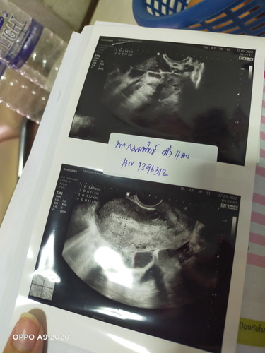 ซาวด์ไม่เจอเด็ก