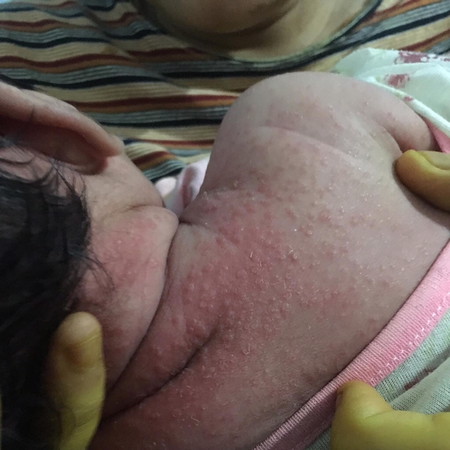 Bé bị gì đây vậy mn ???