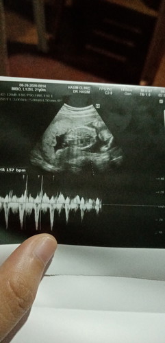 Ultrasound