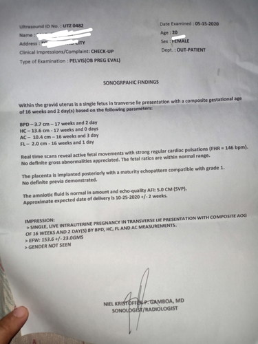 Sino marunong bumasa ng result