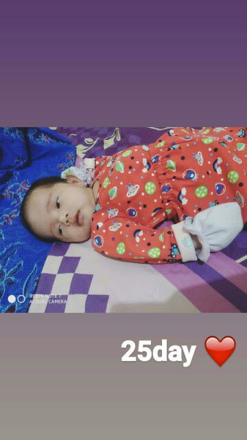 miring2 bayi 25hari