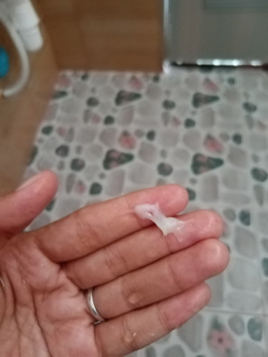 แม่มีตกขาว/มูก ออกมาแบบนี้