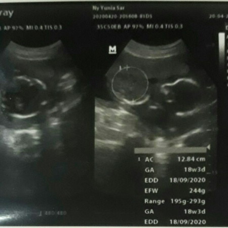 mau melihat aktiftas anak saya di perut