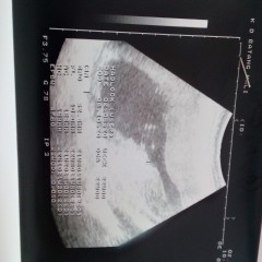 Baby .